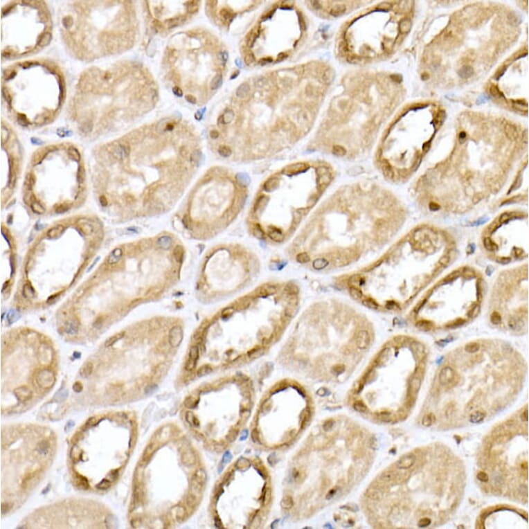 Immunohistochemistry - Anti-Von Hippel Lindau/VHL Antibody (A12623) - Antibodies.com