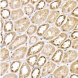 Immunohistochemistry - Anti-Von Hippel Lindau/VHL Antibody (A12623) - Antibodies.com