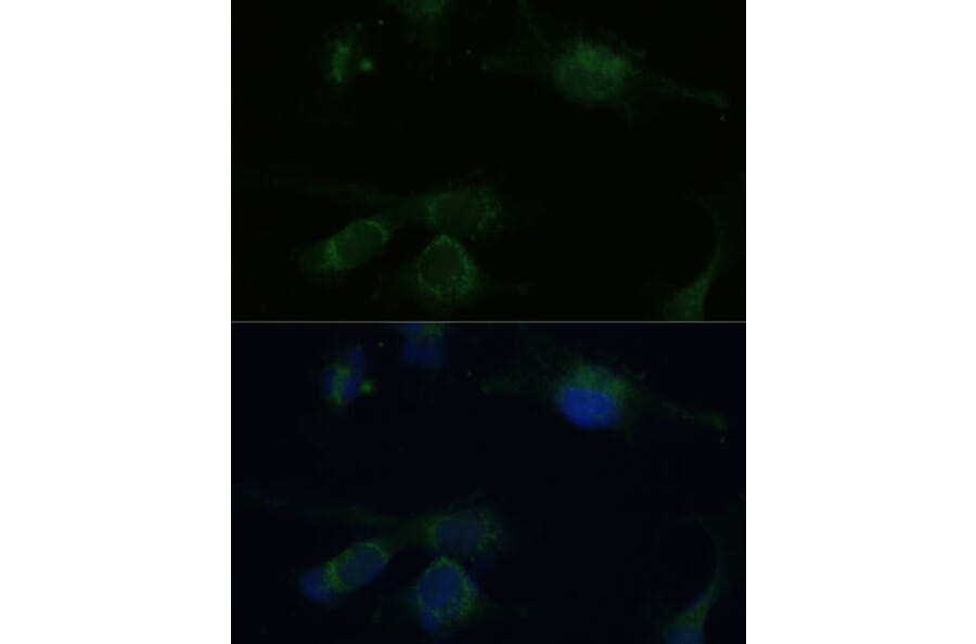 Immunofluorescence - Anti-Von Hippel Lindau/VHL Antibody (A12623) - Antibodies.com