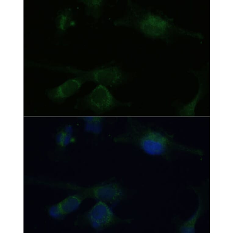 Immunofluorescence - Anti-Von Hippel Lindau/VHL Antibody (A12623) - Antibodies.com
