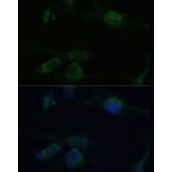 Immunofluorescence - Anti-Von Hippel Lindau/VHL Antibody (A12623) - Antibodies.com