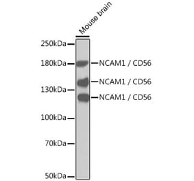 Western Blot - Anti-NCAM1 Antibody (A12624) - Antibodies.com
