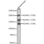 Western Blot - Anti-NCAM1 Antibody (A12624) - Antibodies.com