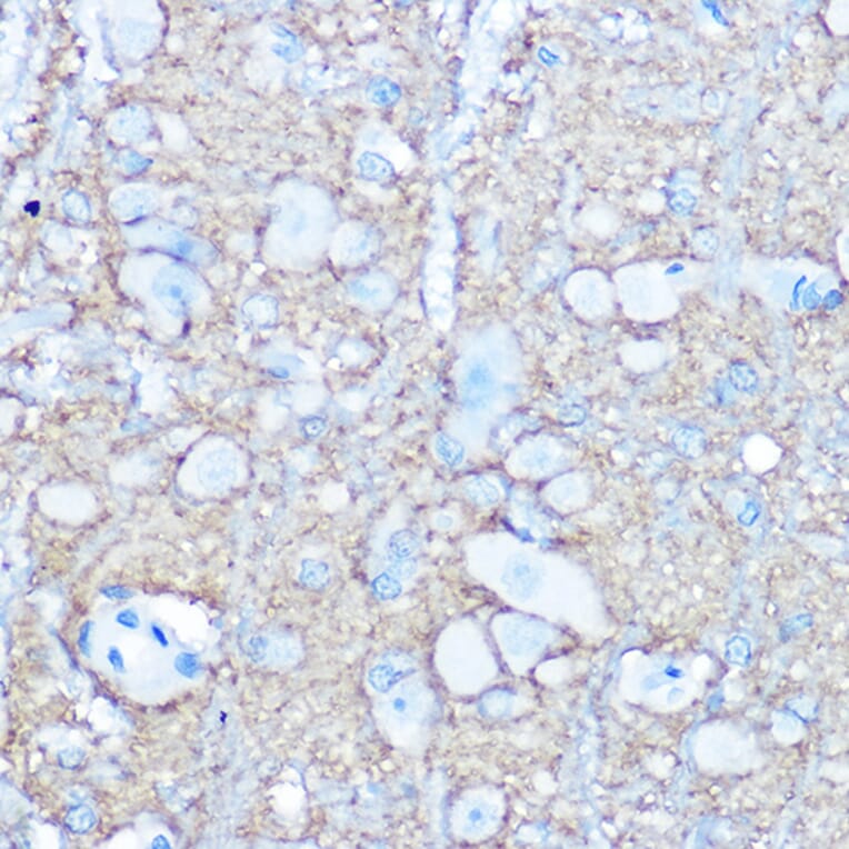 Immunohistochemistry - Anti-NCAM1 Antibody (A12624) - Antibodies.com