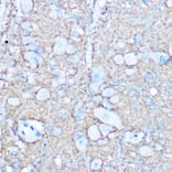 Immunohistochemistry - Anti-NCAM1 Antibody (A12624) - Antibodies.com