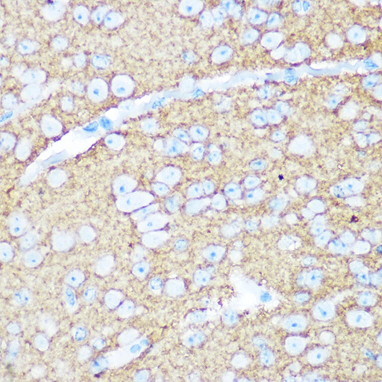 Immunohistochemistry - Anti-NCAM1 Antibody (A12624) - Antibodies.com