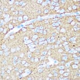Immunohistochemistry - Anti-NCAM1 Antibody (A12624) - Antibodies.com