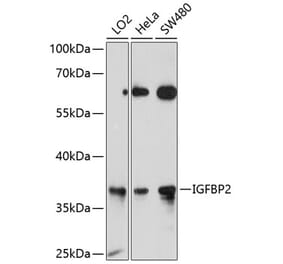 Western Blot - Anti-IGFBP2 Antibody (A12625) - Antibodies.com