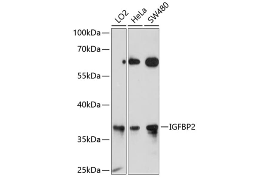 Western Blot - Anti-IGFBP2 Antibody (A12625) - Antibodies.com
