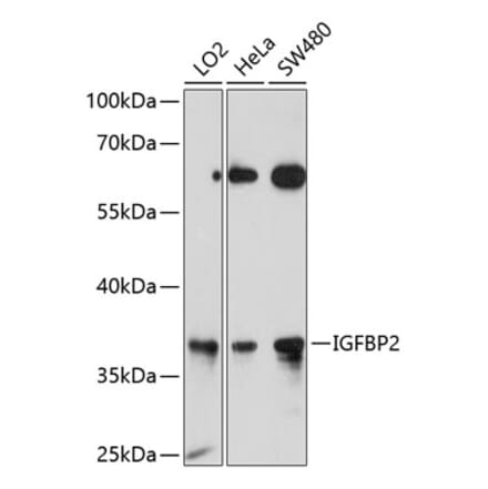 Western Blot - Anti-IGFBP2 Antibody (A12625) - Antibodies.com