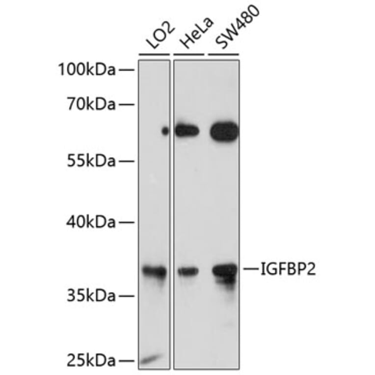 Western Blot - Anti-IGFBP2 Antibody (A12625) - Antibodies.com
