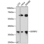 Western Blot - Anti-IGFBP2 Antibody (A12625) - Antibodies.com