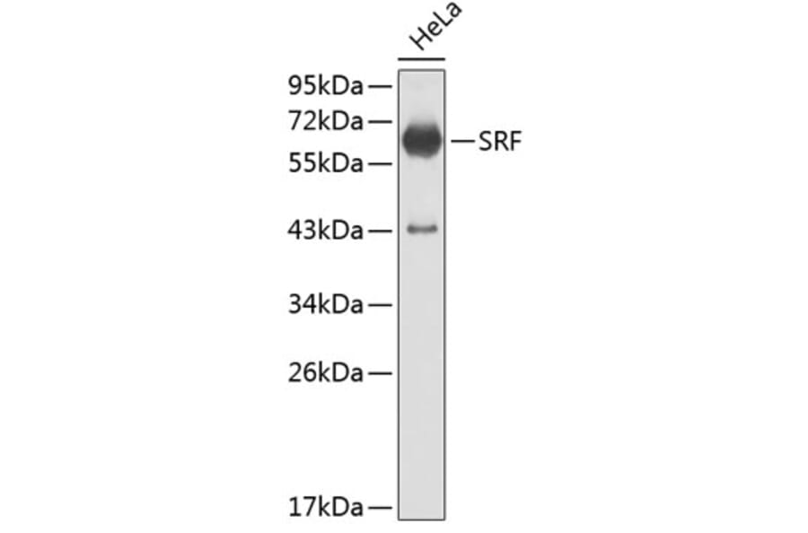 Western Blot - Anti-SRF Antibody (A0409) - Antibodies.com