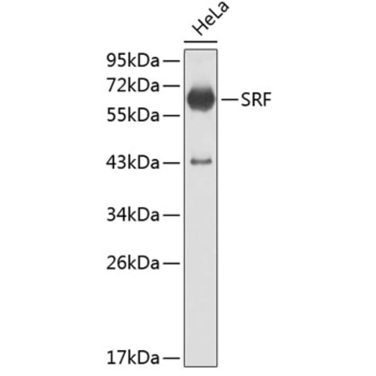 Western Blot - Anti-SRF Antibody (A0409) - Antibodies.com