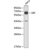 Western Blot - Anti-SRF Antibody (A0409) - Antibodies.com