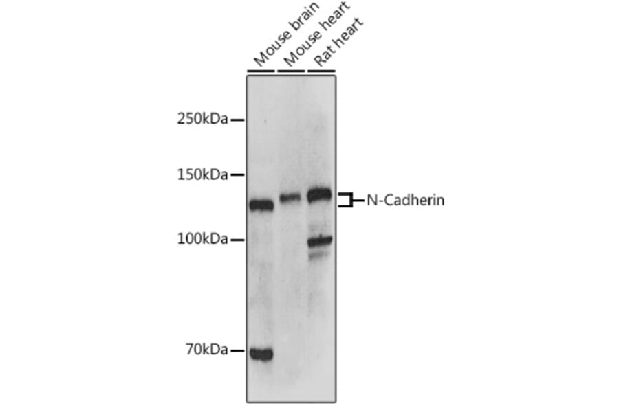 Western Blot - Anti-N Cadherin Antibody (A12629) - Antibodies.com