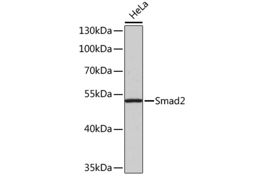 Western Blot - Anti-Smad2 Antibody (A12630) - Antibodies.com