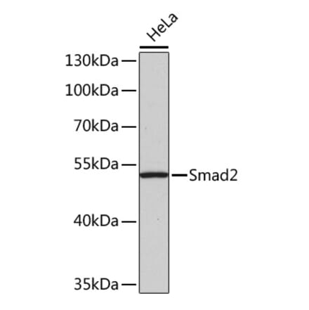 Western Blot - Anti-Smad2 Antibody (A12630) - Antibodies.com