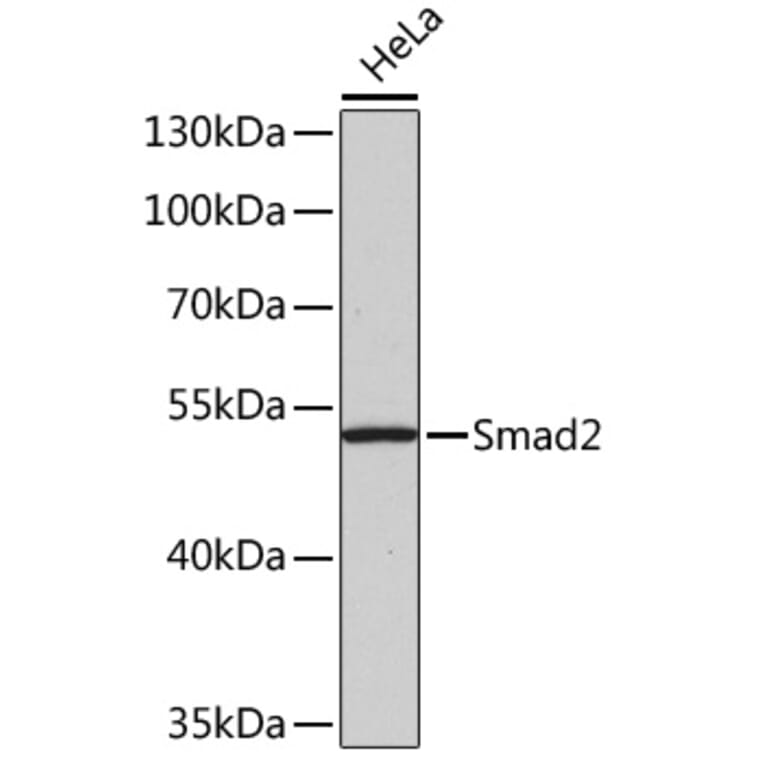 Western Blot - Anti-Smad2 Antibody (A12630) - Antibodies.com