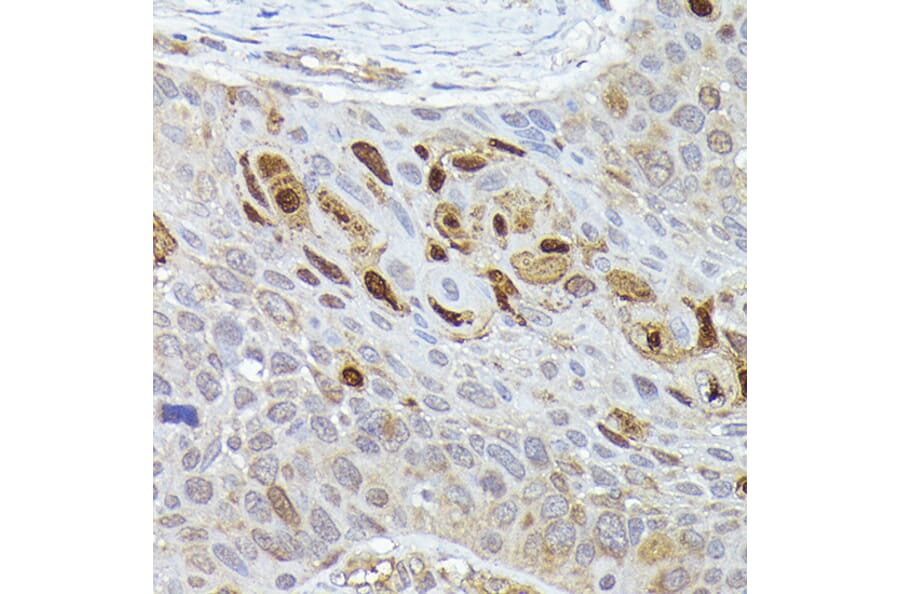 Immunohistochemistry - Anti-Smad2 Antibody (A12630) - Antibodies.com