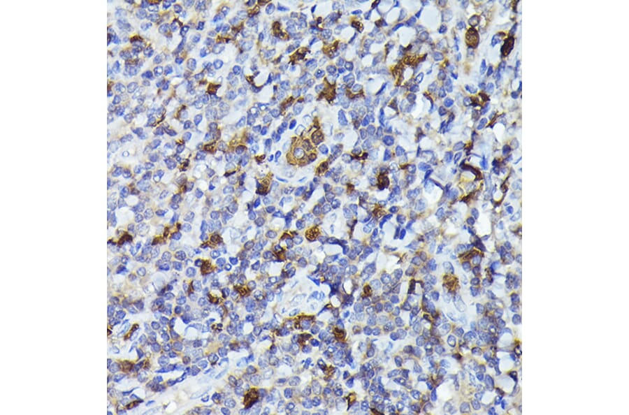 Immunohistochemistry - Anti-Smad2 Antibody (A12630) - Antibodies.com