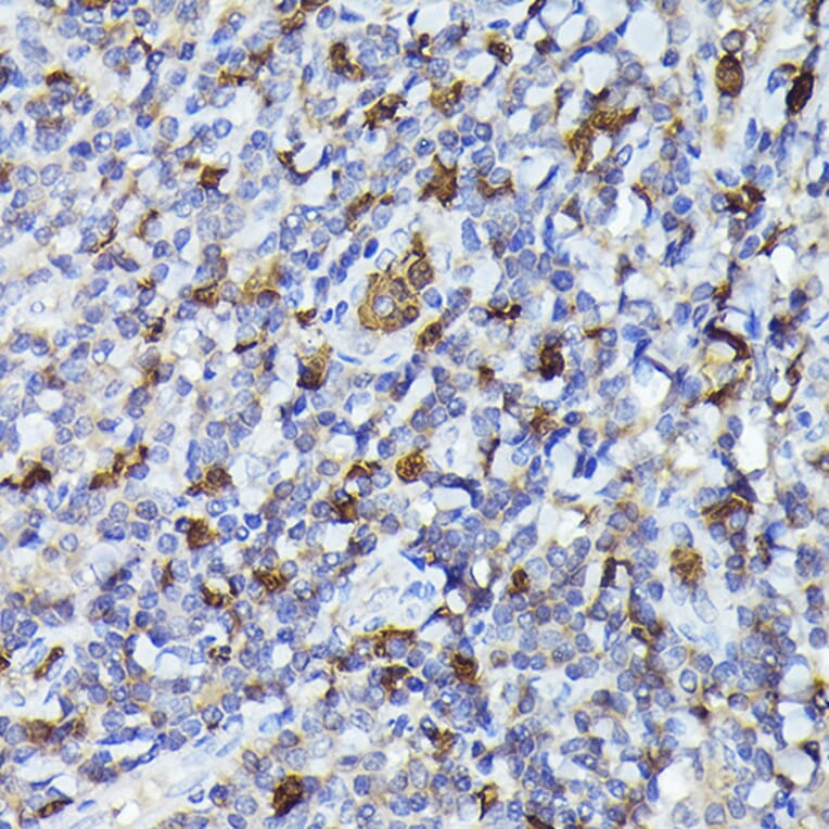 Immunohistochemistry - Anti-Smad2 Antibody (A12630) - Antibodies.com
