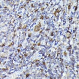 Immunohistochemistry - Anti-Smad2 Antibody (A12630) - Antibodies.com