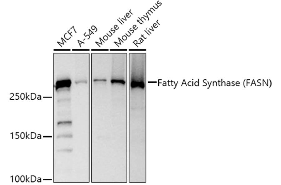 Western Blot - Anti-Fatty Acid Synthase Antibody (A12631) - Antibodies.com