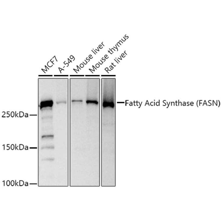 Western Blot - Anti-Fatty Acid Synthase Antibody (A12631) - Antibodies.com