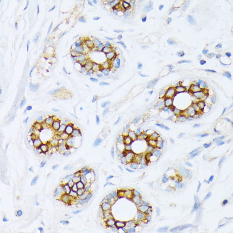 Immunohistochemistry - Anti-Fatty Acid Synthase Antibody (A12631) - Antibodies.com