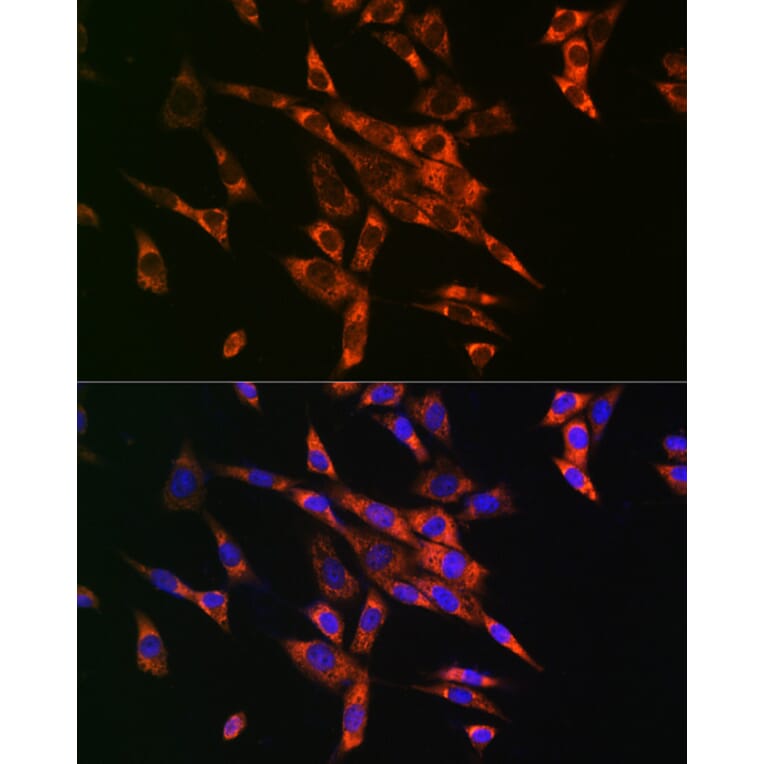 Immunofluorescence - Anti-Fatty Acid Synthase Antibody (A12631) - Antibodies.com