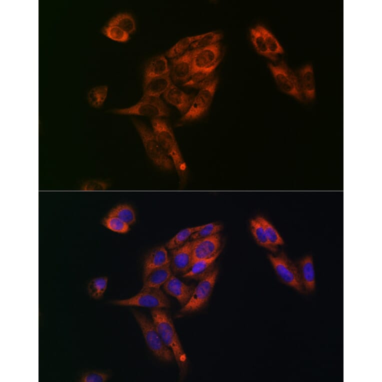 Immunofluorescence - Anti-Fatty Acid Synthase Antibody (A12631) - Antibodies.com