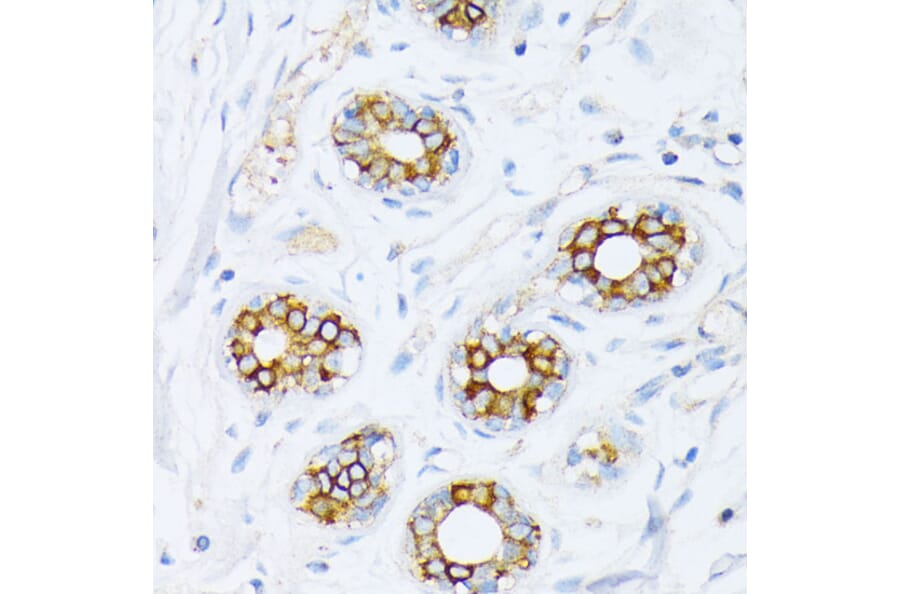 Immunohistochemistry - Anti-Fatty Acid Synthase Antibody (A12631) - Antibodies.com