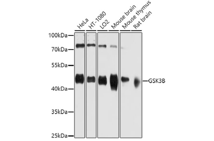 Western Blot - Anti-GSK3B Antibody (A0479) - Antibodies.com