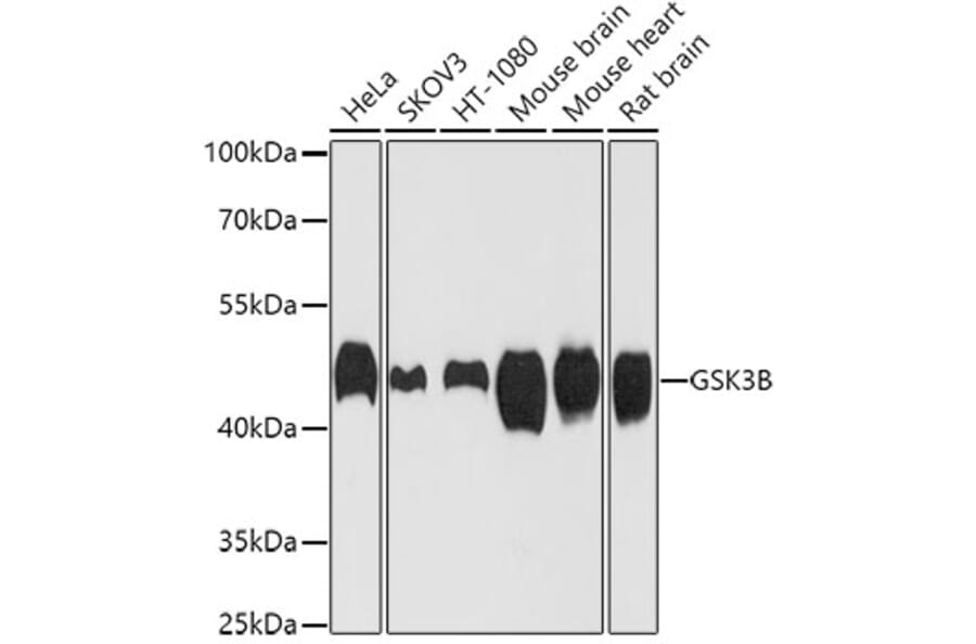 Western Blot - Anti-GSK3B Antibody (A0480) - Antibodies.com