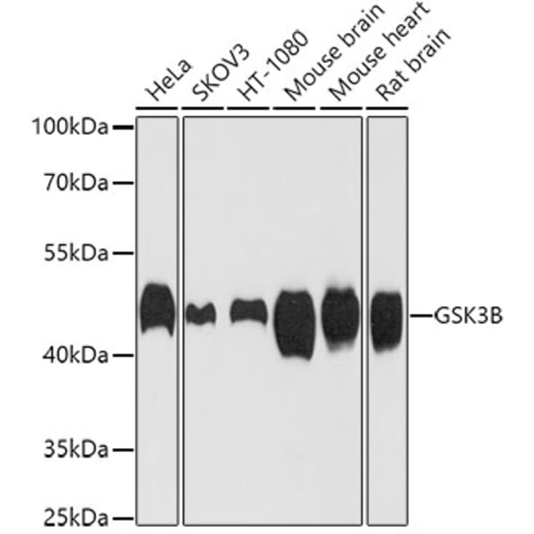 Western Blot - Anti-GSK3B Antibody (A0480) - Antibodies.com