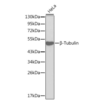 Western Blot - Anti-beta Tubulin Antibody (A12636) - Antibodies.com