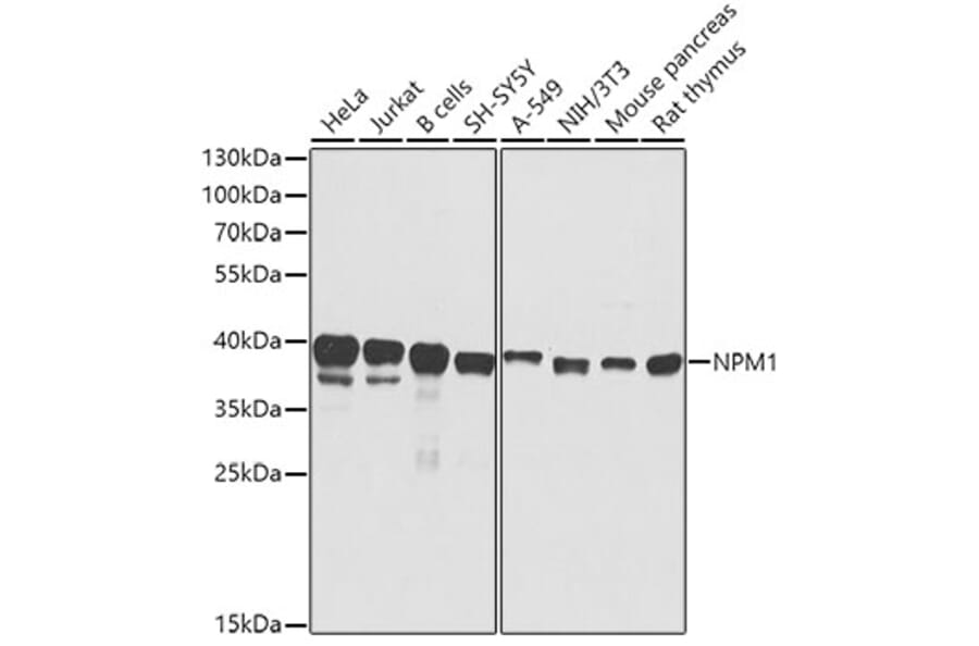 Western Blot - Anti-NPM1 Antibody (A0486) - Antibodies.com