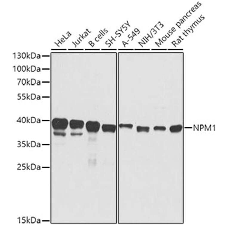 Western Blot - Anti-NPM1 Antibody (A0486) - Antibodies.com