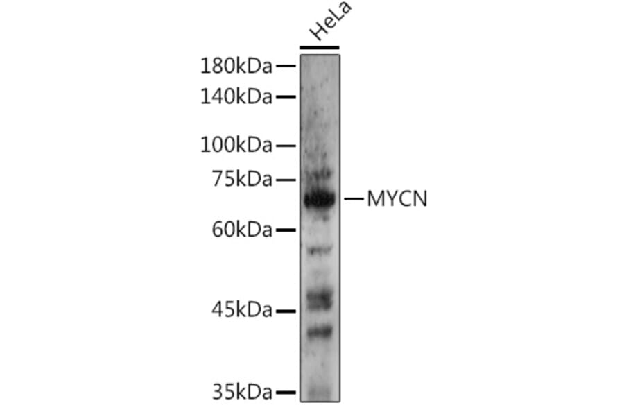 Western Blot - Anti-n-Myc/MYCN Antibody (A12638) - Antibodies.com