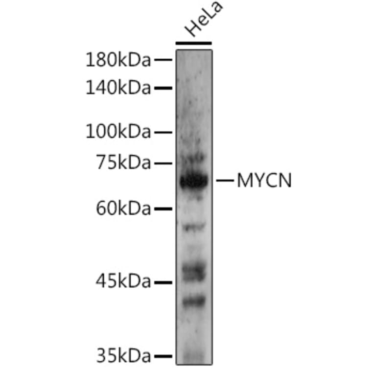 Western Blot - Anti-n-Myc/MYCN Antibody (A12638) - Antibodies.com
