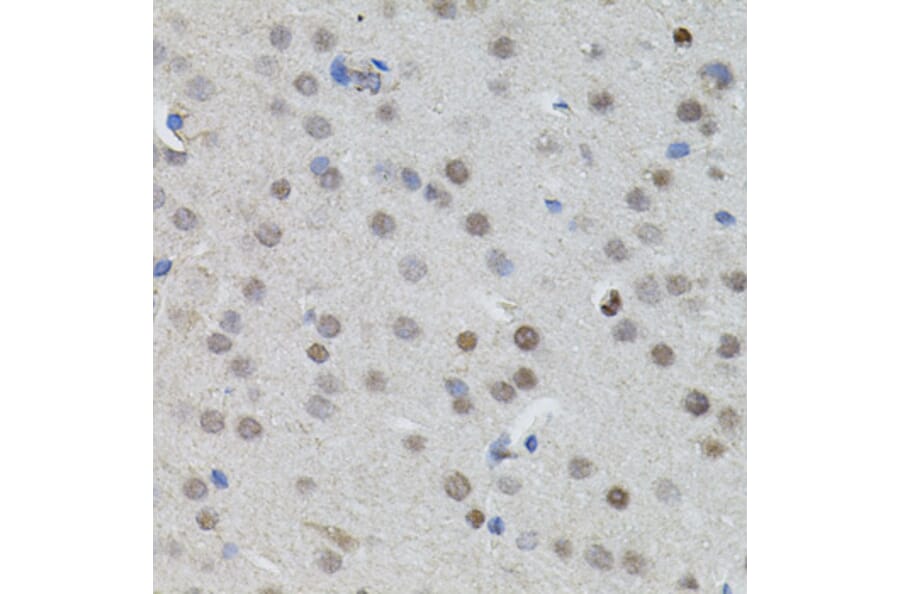 Immunohistochemistry - Anti-n-Myc/MYCN Antibody (A12638) - Antibodies.com