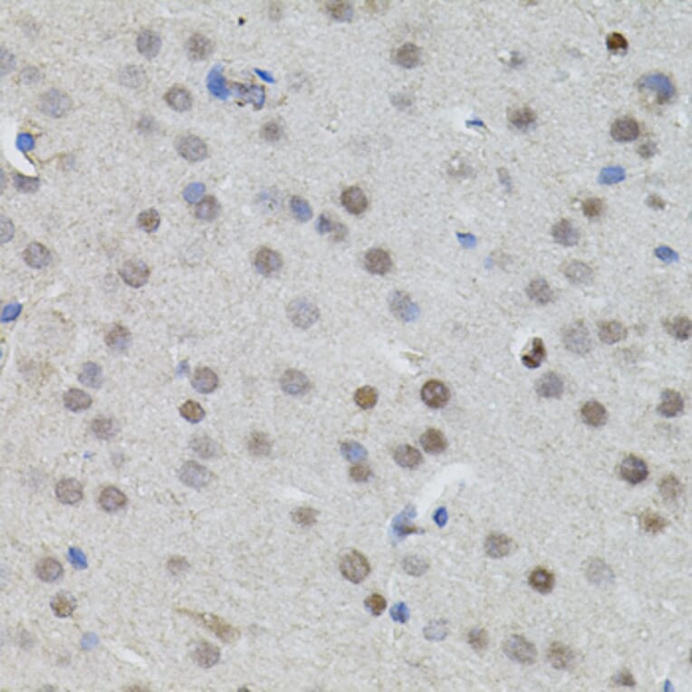 Immunohistochemistry - Anti-n-Myc/MYCN Antibody (A12638) - Antibodies.com