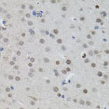 Immunohistochemistry - Anti-n-Myc/MYCN Antibody (A12638) - Antibodies.com