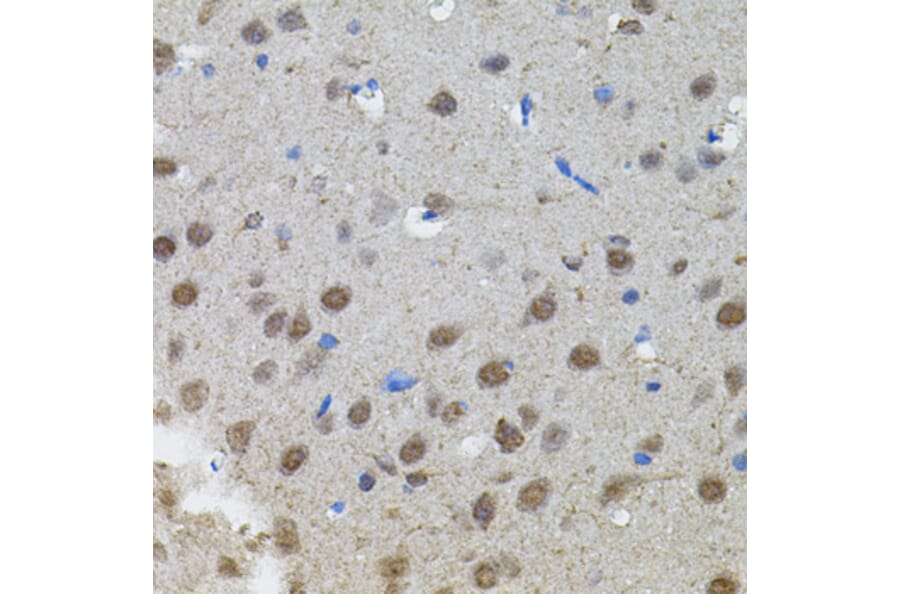 Immunohistochemistry - Anti-n-Myc/MYCN Antibody (A12638) - Antibodies.com