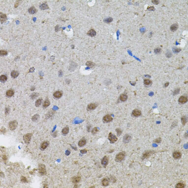 Immunohistochemistry - Anti-n-Myc/MYCN Antibody (A12638) - Antibodies.com