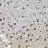 Immunohistochemistry - Anti-n-Myc/MYCN Antibody (A12638) - Antibodies.com