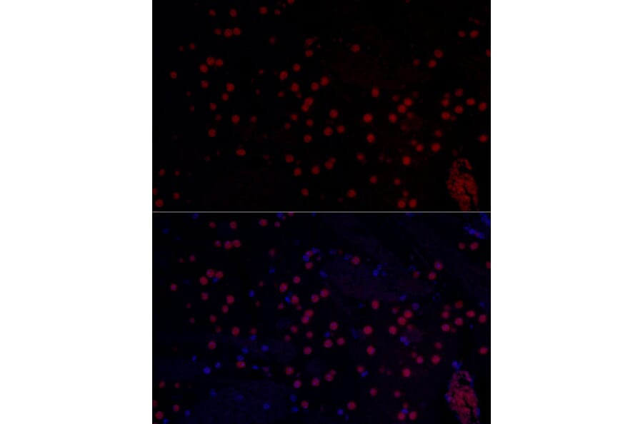 Immunofluorescence - Anti-n-Myc/MYCN Antibody (A12638) - Antibodies.com