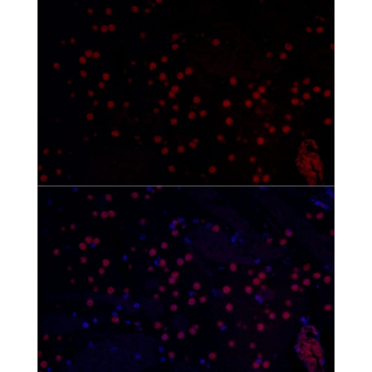 Immunofluorescence - Anti-n-Myc/MYCN Antibody (A12638) - Antibodies.com