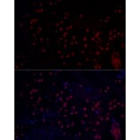 Immunofluorescence - Anti-n-Myc/MYCN Antibody (A12638) - Antibodies.com